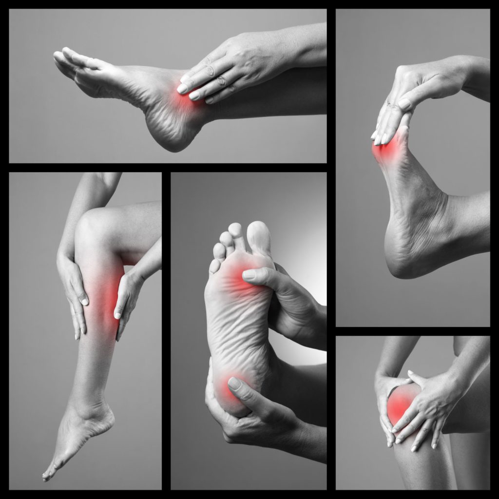 Grafik mit Darstellung von Füßen und Gelenken. Schmerzen an diesen Stellen sind durch rote Flächen symbolisiert.